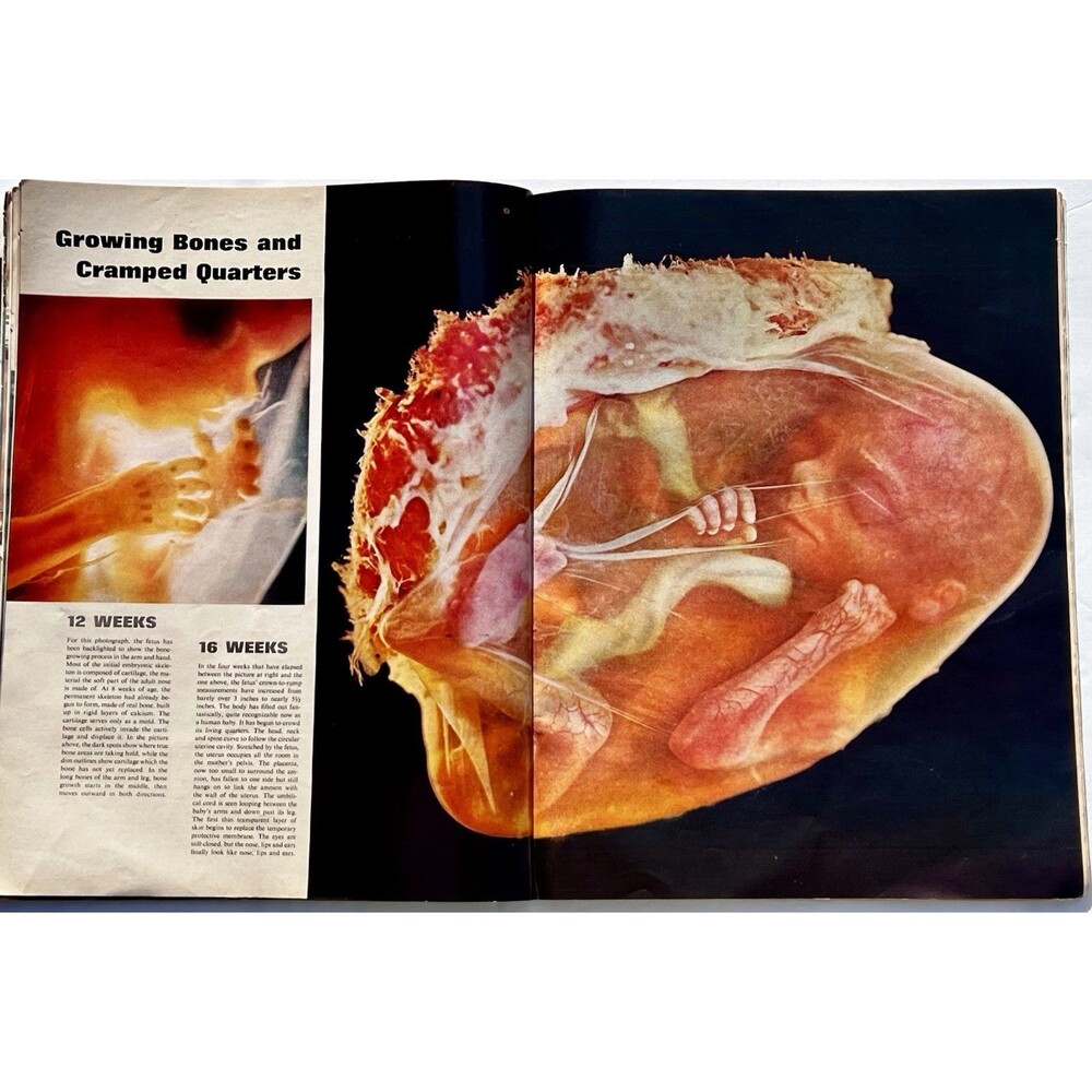 LIFE Magazine April 30, 1965 Drama Of Life Before Birth Issue - Picture 6 of 10